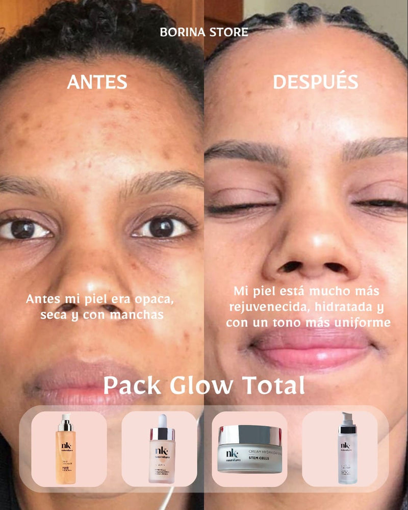 PACK GLOW TOTAL | NATURAL KIREI  Dile adiós a los poros abiertos, manchas, brillos y arrugas